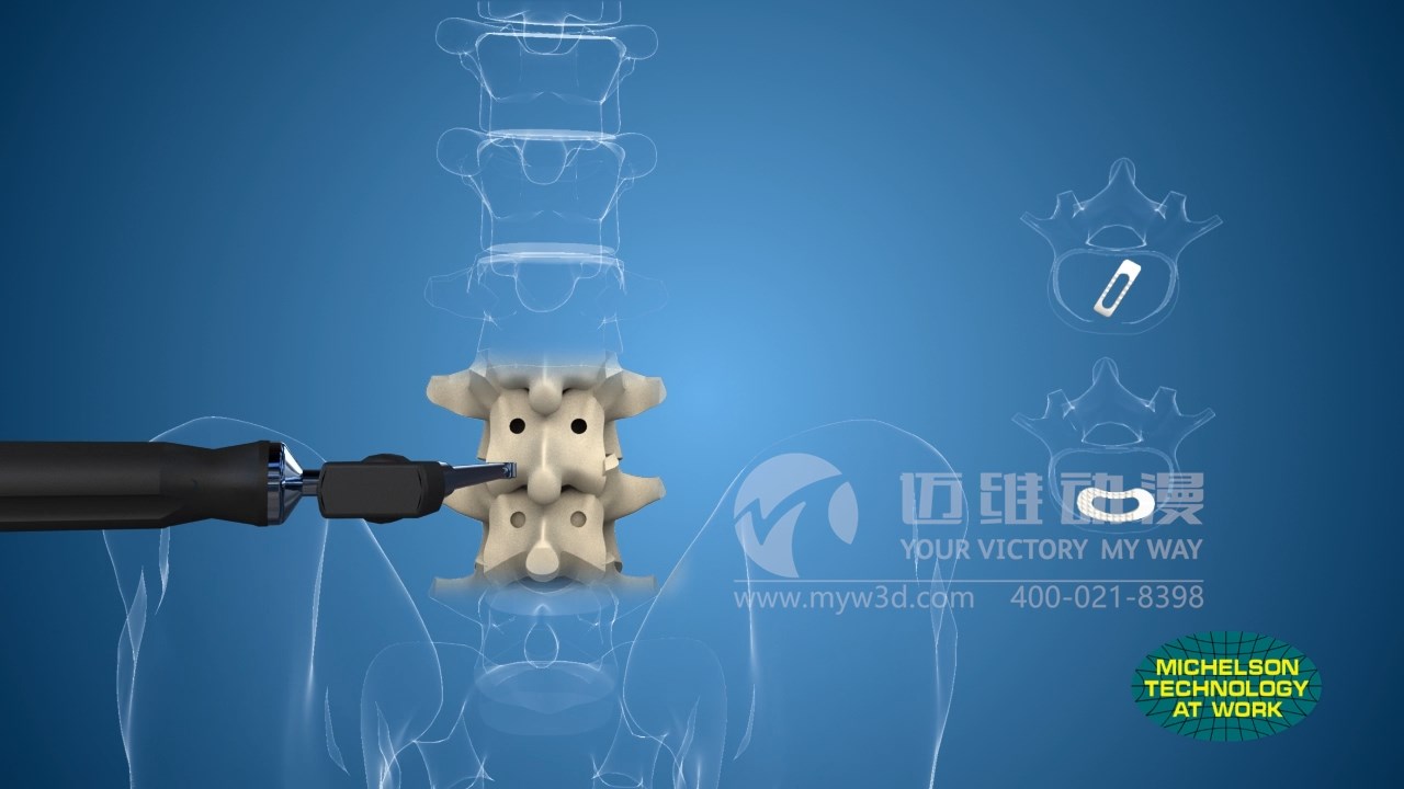 醫(yī)療三維動(dòng)畫(huà)制作.jpg